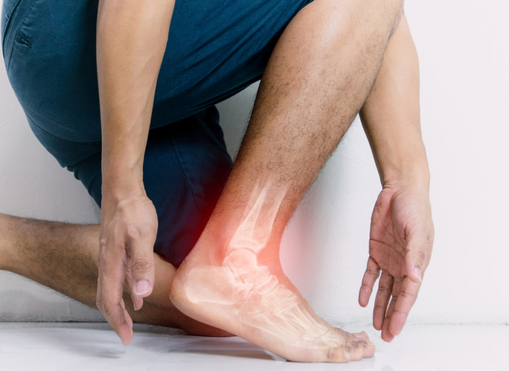 What is Ankle Pain? || image