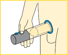 What is a Vacuum Erection Device? || image