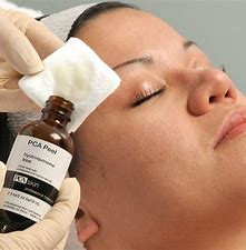 Chemical Peel