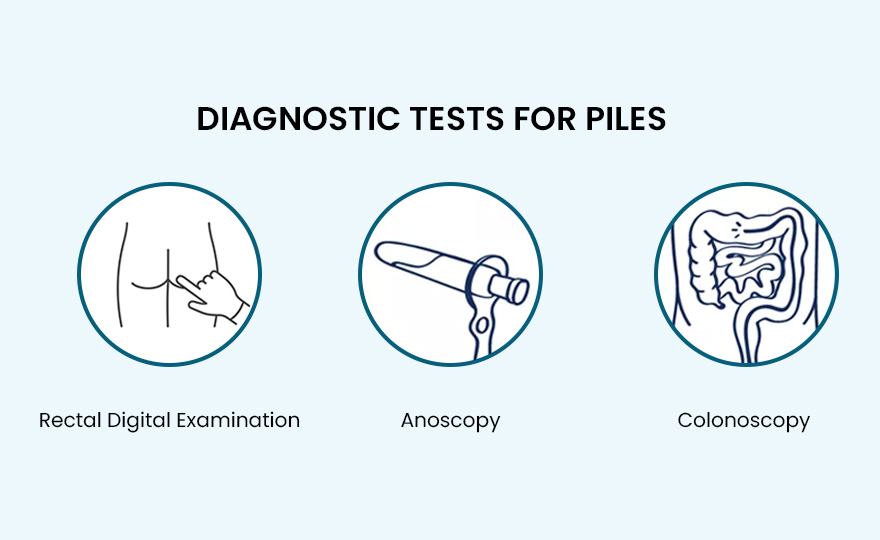 Piles Symptoms, Meaning, Images, Causes and Types